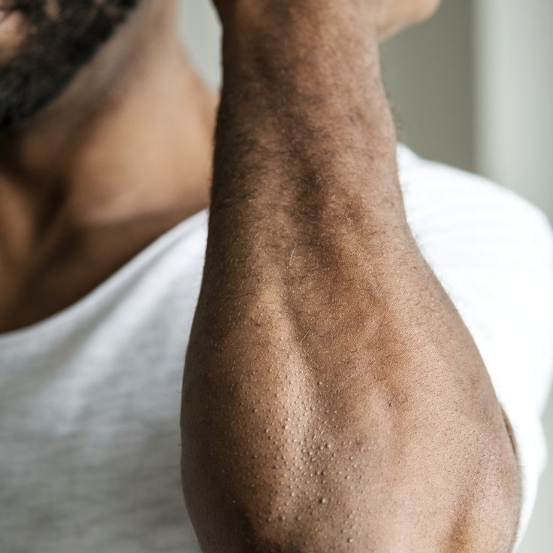 Dry Skin